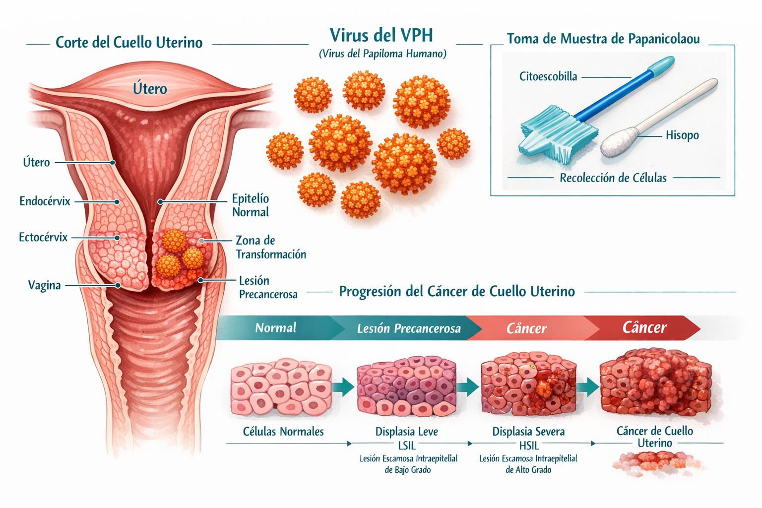 Detailed () educational infographic-style illustration showing a cross-section diagram of the female cervix with HPV virus