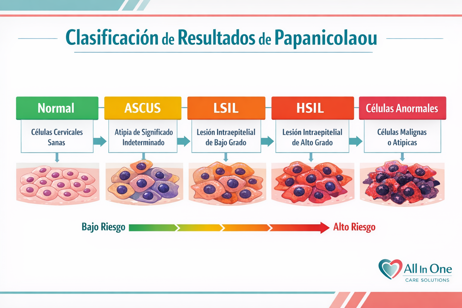 Detailed () illustrative medical infographic showing the Pap smear result classification system: a clean horizontal flow
