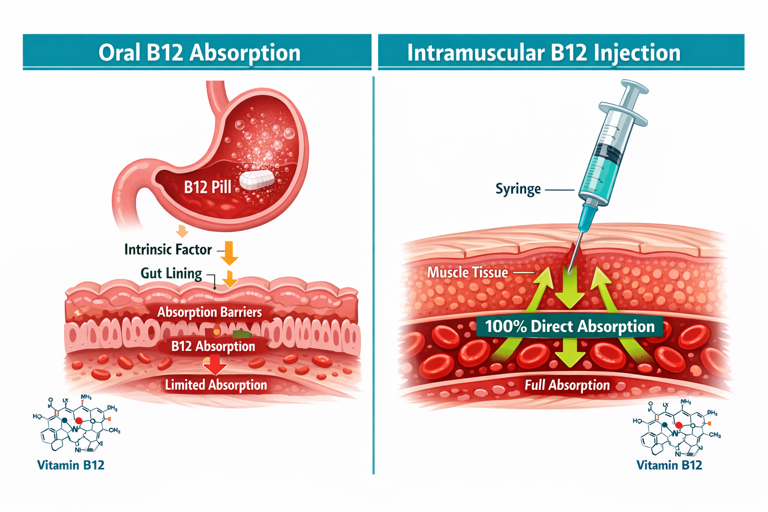Detailed () scientific illustration showing a cross-section diagram of intramuscular B12 injection delivery versus oral pill